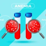 რა არის რკინადეფიციტური ანემია